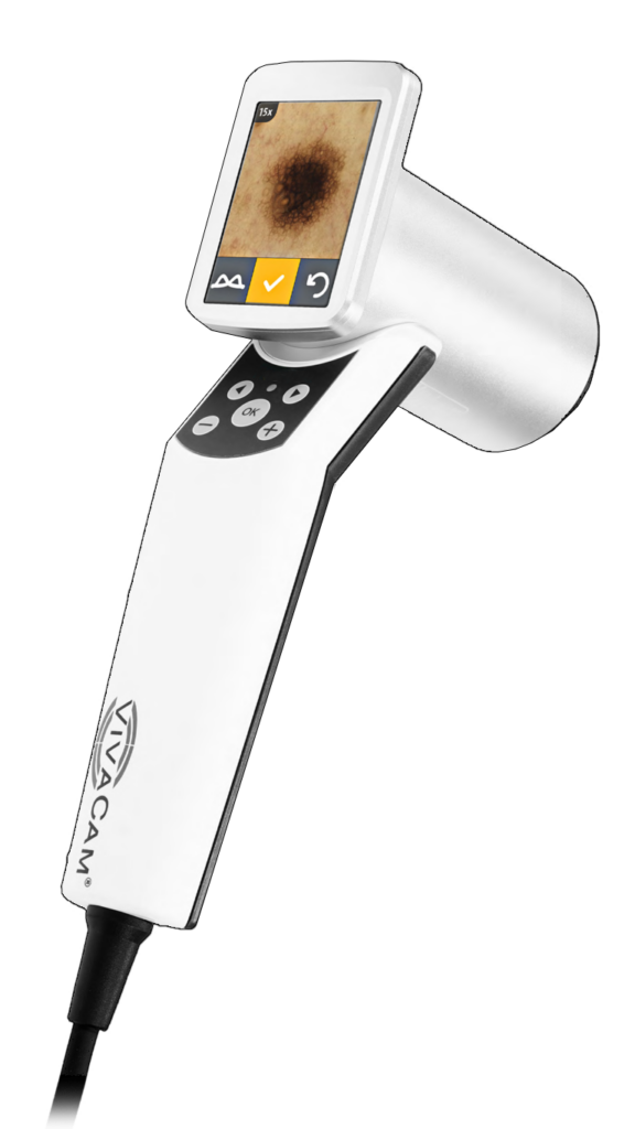 VivaCam D200 is a digital dermatoscope and included in every vivascope in vivo system