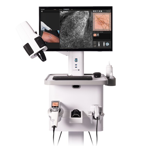 The VivaScope 1500/300 Combo System, confocal laser scan microscope